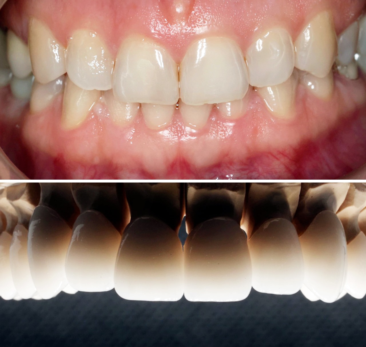 «Красивая улыбка - результат высокого мастерства врача, цифровых технологий и функциональной диагности»