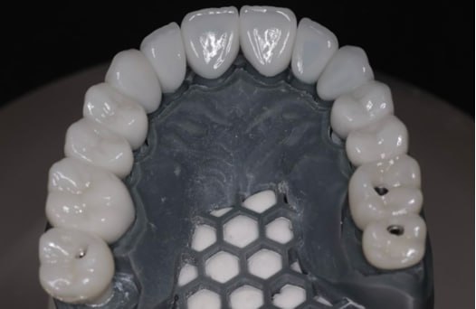 Готовые виниры на 3D модели