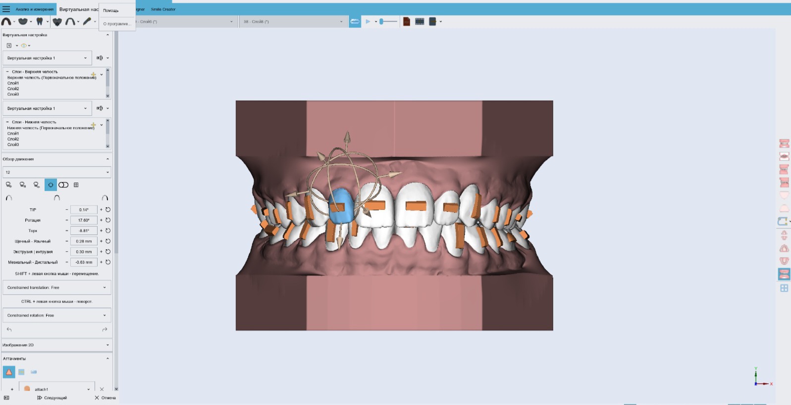 «Красивая улыбка - результат высокого мастерства врача, цифровых технологий и функциональной диагности»