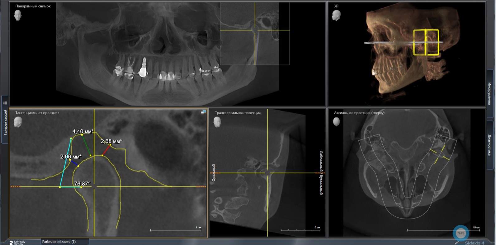 «Красивая улыбка - результат высокого мастерства врача, цифровых технологий и функциональной диагности»
